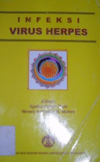 Image of Infeksi Virus Herpes